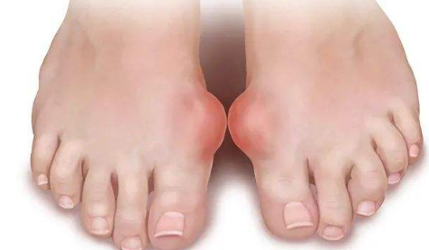 ����ߵ�720�������̶� ����720����ҩ����